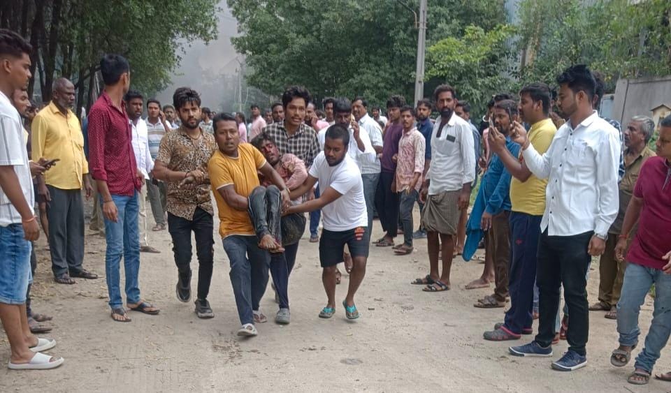 Telangana factory blast, Hyderabad factory blast, Telangana chemical factory blast, Sigachi Pharma explosion, Sangareddy industrial accident, Hyderabad factory