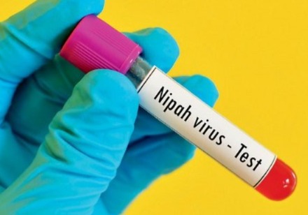 Nipah Virus, What is Nipah Virus, History of Nipah Virus, Symptoms of Nipah Virus, How Nipah Virus spreads, Nipah Virus in Kerala, Treatment of Nipah Virus, Death due to Nipah Virus, Nipah Virus Explained. Bats,