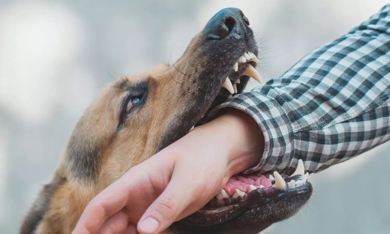 What is rabies, rabies, rabies case, how rabies happens, dog bite, dog attack. Rabies symptoms, rabies prevention, rabies treatment, rabies research,